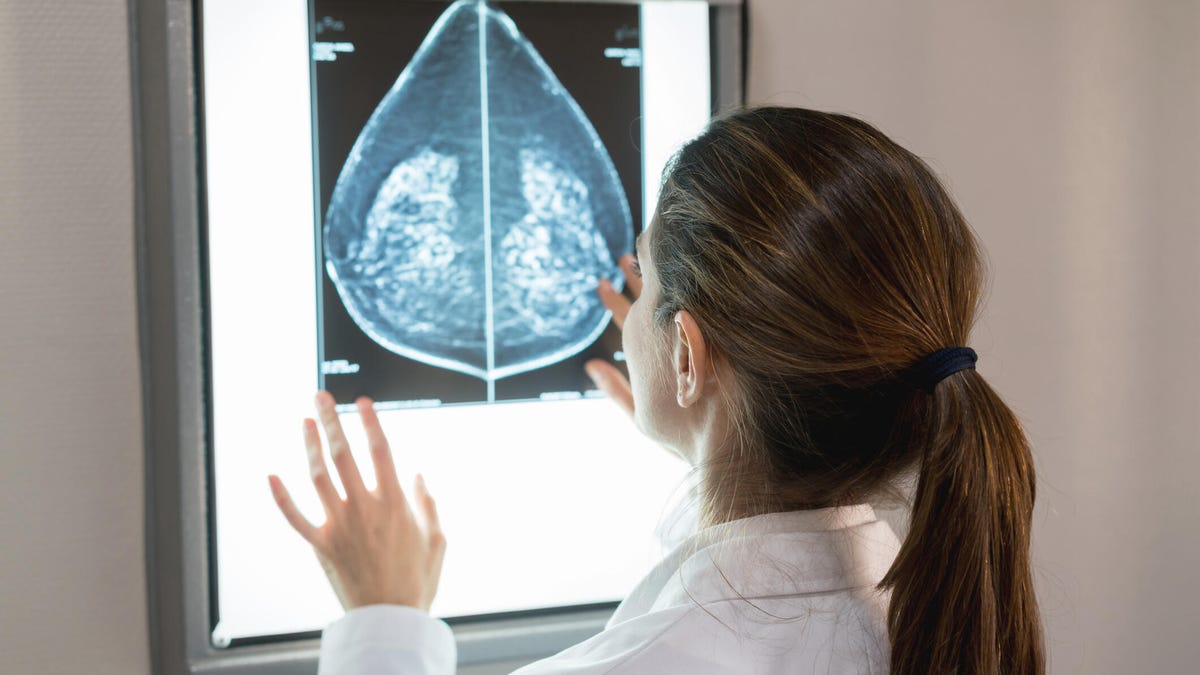 A doctor with brown hair in a ponytail looking at a mammogram X-ray.