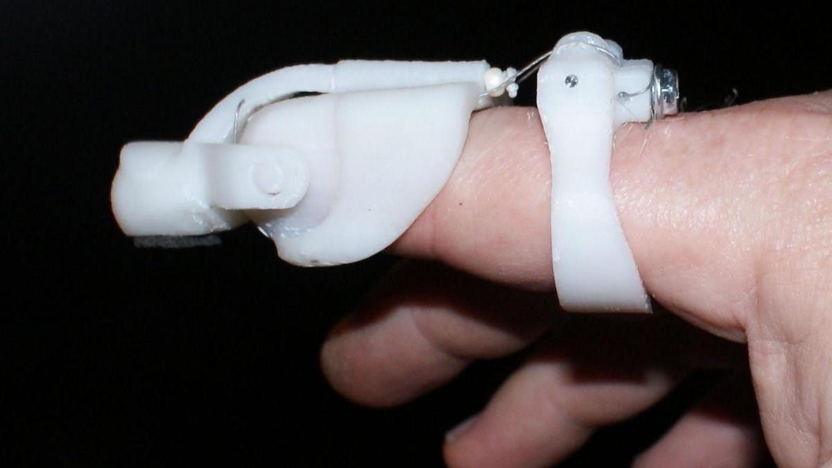 Prosthetic fingertip