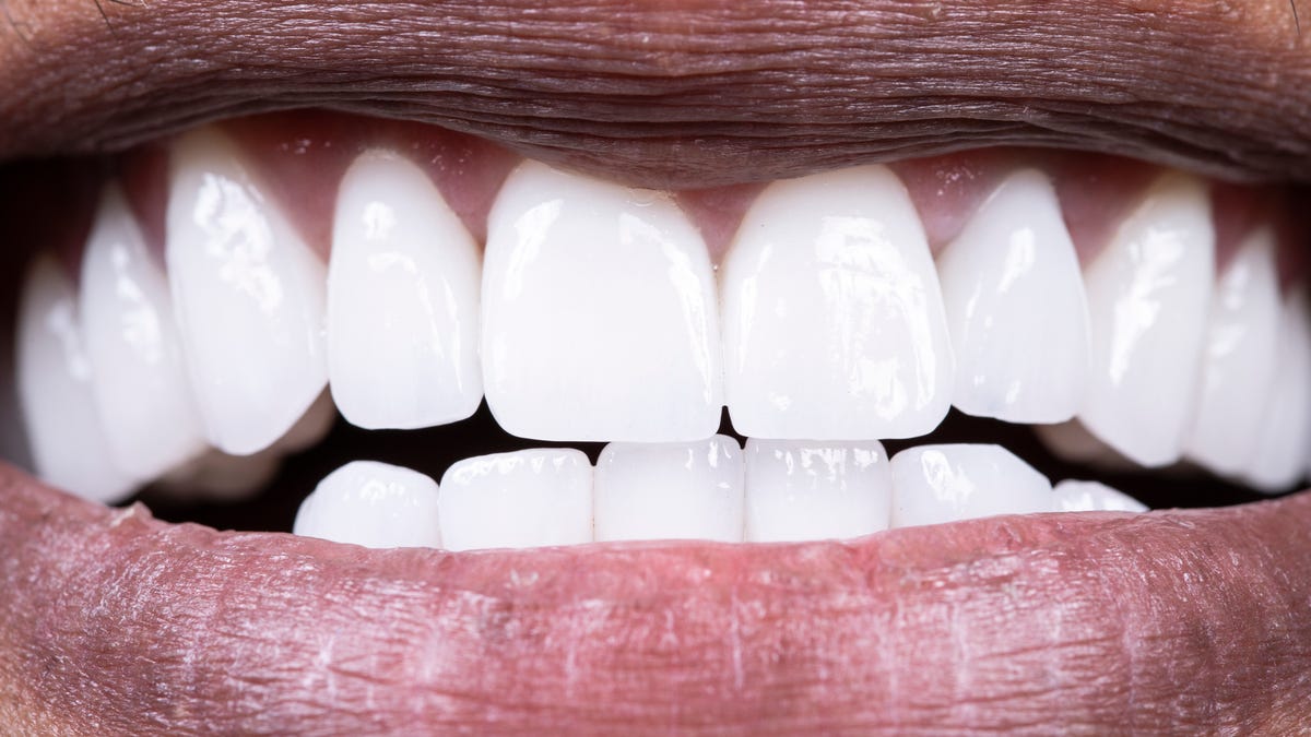 A close-up image of someone's white teeth while smiling.