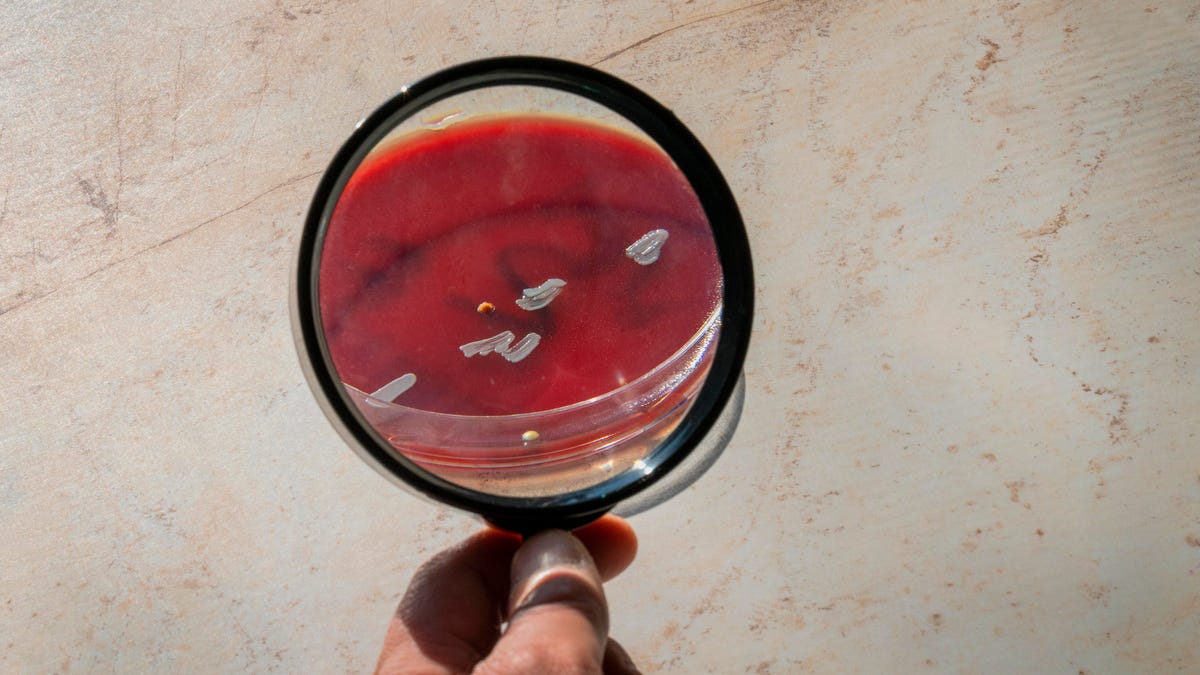 The monkeypox virus under a microscope